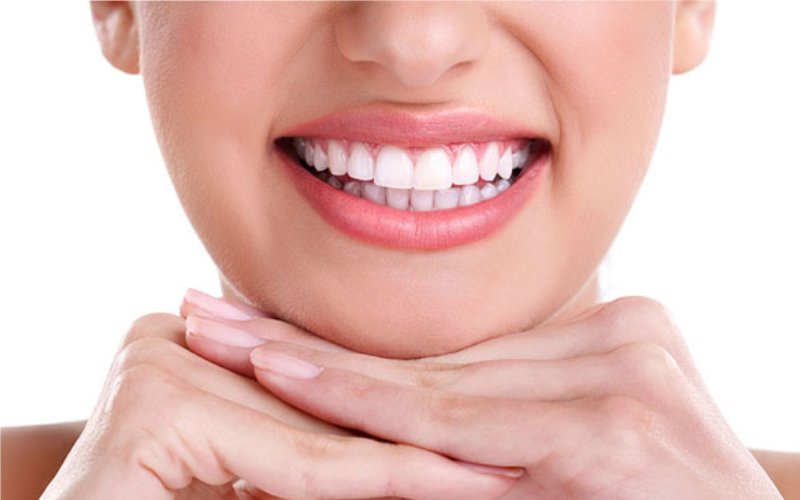 Estetik Dolgu - Atadent Bursa Diş Polikliniği