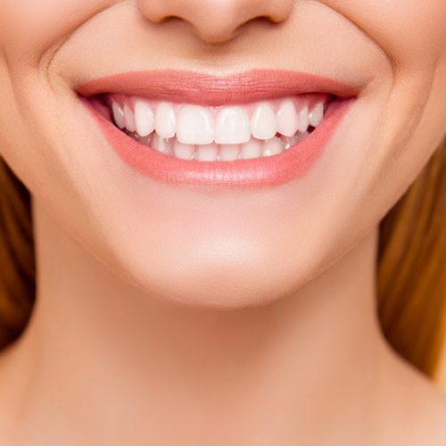 İmplantüstü Protez - Atadent Bursa Diş Polikliniği